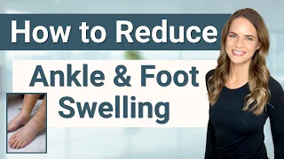How to Treat Foot, Ankle, and Leg Lymphedema and Swelling - From a Lymphedema Therapist
