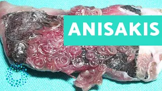 Lista de pescados con Anisakis - CONSEJOS DE SALUD