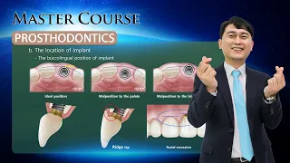 [Master Course - PROSTHODONTICS] Diagnosis and Tx. planning for Anterior esthetic implant Prosthesis