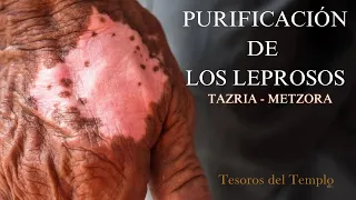 La Purificación de los Leprosos en la Parasha - Tazria- Metzora - Rico Cortes