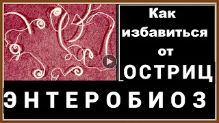 ЭНТЕРОБИОЗ - КАК ИЗБАВИТЬСЯ ОТ ОСТРИЦ