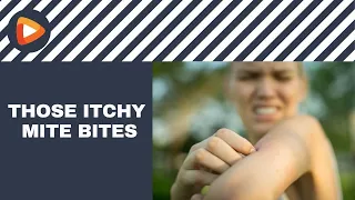 Are Itchy Mite Bites Bugging You? Watch This.