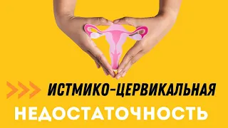 ИСТМИКО-ЦЕРВИКАЛЬНАЯ НЕДОСТАТОЧНОСТЬ @DrOlenaB #olenaberezovska #беременность