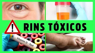 RINS tóxicos -10 Sinais INICIAIS de ALERTA de DOENÇA RENAL Que Você NÃO Pode Ignorar! Dr Alain Dutra