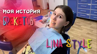 СТАВЛЮ БРЕКЕТЫ| Lina Style