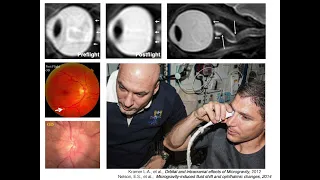 Space V4.2  Microgravity and Fluids in the Body