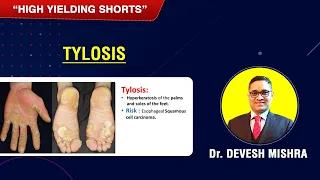 High Yielding Short-11(#HYS-11) : Tylosis by Dr. Devesh Mishra.