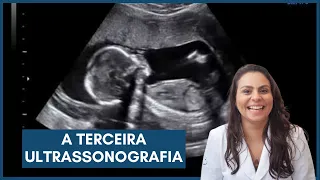 A terceira ultrassonografia - Dra. Maíra de La Rocque
