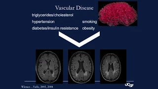 “Healthy Brain Aging” by Kaitlin Casaletto, PhD, at MAC Research Education Event