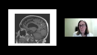 Webinar: Updates on Frontotemporal Dementia with Dr. Elizabeth Finger. Recorded October 20, 2021.