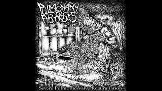 Pulmonary Fibrosis – Severe Pulmonic Valve Regurgitation (EP) (2021 - Goregrind)