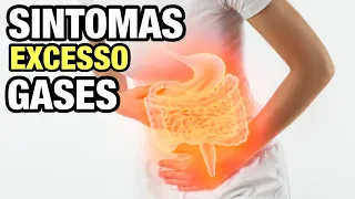 SINTOMAS causados por EXCESSO de GASES INTESTINAIS |