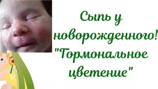 Акне новорожденных! Сыпь у новорожденного ребенка👶"Гормональное цветение"