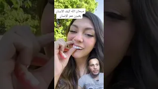 ملامحها اتغيرت بمجرد ما شالت طقم الاسنان 💔👌