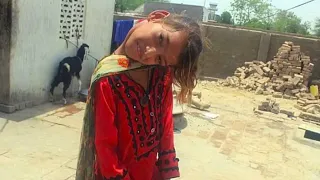 This Girl Lived With Her Neck Bent at a 90-Degree Angle for 12 Years. The Story of Afsheen Gul