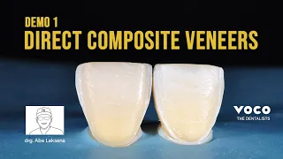 Step by Step Direct Composite Veneers Restoration with 2 Layers Technique using AMARIS | VOCO GmbH