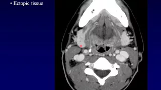 Salivary1