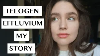 TELOGEN EFFLUVIUM | MY RECOVERY STORY | LAUREN NEWLY