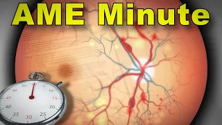 AME Minute: Why must the eye evaluation for ITDM be performed by an ophthalmologist?