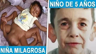 Los 5 Niños Mas Extraños Que Son Únicos En El Mundo