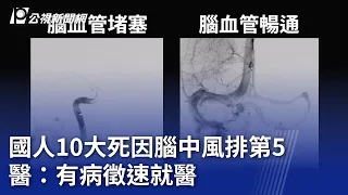 國人10大死因腦中風排第5 醫：有病徵速就醫｜20240530 公視晚間新聞