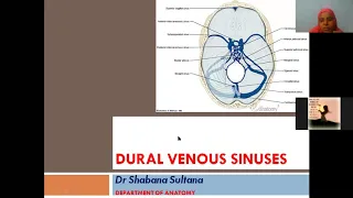 Dural venous sinuses Anatomy Dr Shabana(1)