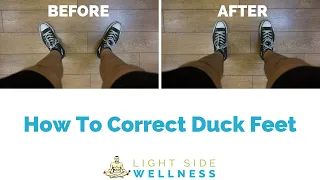 How To Correct Duck Feet (Feet Turn Out) | Step By Step Program