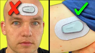 Huge Dexcom G6 Mistakes That Will Cost You…