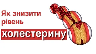 Як знизити рівень холестерину? | сімейний лікар Інна Матішинець | Ранок надії | телеканал Надія