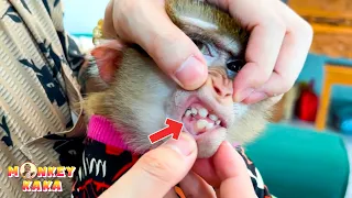 Dad was surprised to see Monkey Kaka lose her teeth