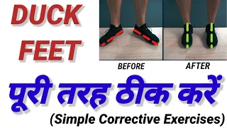 How to correct DUCK FEET in Hindi | Fix  DUCK FEET posture | DUCK FEET corrective exercises in Hindi