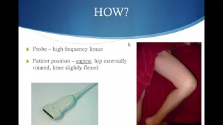 POCUS for Lower Extremity DVT