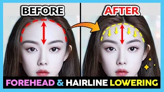 ✨ MASSAGE FOREHEAD REDUCTION & HAIRLINE LOWERING | GET A SMALL FOREHEAD AND SHORTEN THE BIG FOREHEAD