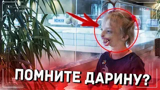 Мать упала при виде её! КАК сейчас выглядит Дарина Шпенглер которая родилась БЕЗ губ и подбородка..?