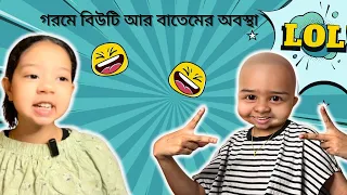 বাতেম যদি চুল নিয়ে খোঁ*টা দেয়, কেমনটা লাগে । Funny Video @aponbon