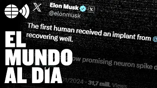 Para qué sirve el chip cerebral de Elon Musk: “El objetivo es tratar enfermedades, por ahora…”