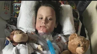 Lisbon boy back home with family after being hit by motocycle