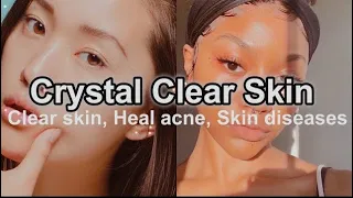 ✧𝗖𝗿𝘆𝘀𝘁𝗮𝗹 𝗖𝗹𝗲𝗮𝗿 𝗦𝗸𝗶𝗻; Have Extremely Smooth Clear Skin Subliminal✧