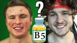 Vitamin B5: The Secret To Clearing Acne?