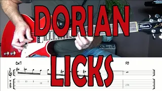 Four Dorian Licks with a Funky Latin Rhythm