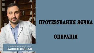 Операція протезування яєчка.