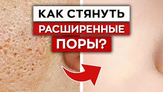 Как бороться с расширенными порами? / Как ухаживать за жирной кожей лица?