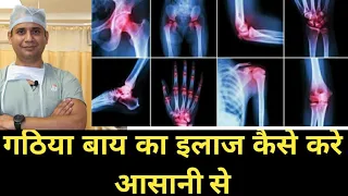 गठिया बाय का पूरा इलाज सरल हिंदी में पहली बार (complete information of Rheumatoid Arthritis)
