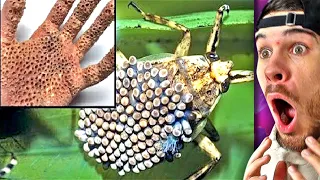 Was passiert, wenn du vom GEFÄHRLICHSTEN Insekt der Welt gebissen wirst?
