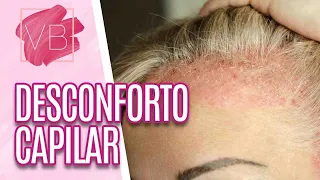 Desconforto Capilar: doenças no couro cabeludo - Você Bonita (31/05/21)