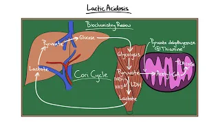 Chalk Talk: AGMA + Lactic Acidosis
