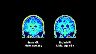 What happens to the brain as we age?