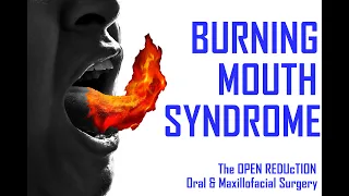 BURNING MOUTH SYNDROME; HOW to DIAGNOSE and TREAT