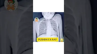 Pushpa X - Ray😂