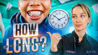 BRACES | How long will it take to complete an Orthodontic Treatment?